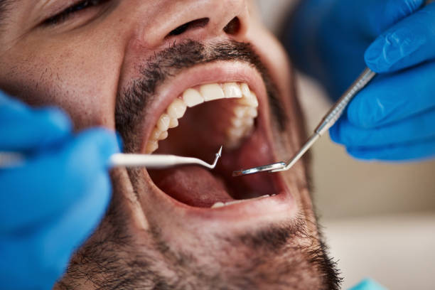 Best Same-Day Emergency Dental Services in Richwood, WV